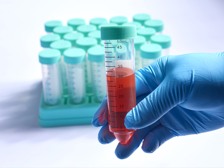 離心管使用注意事項(xiàng)